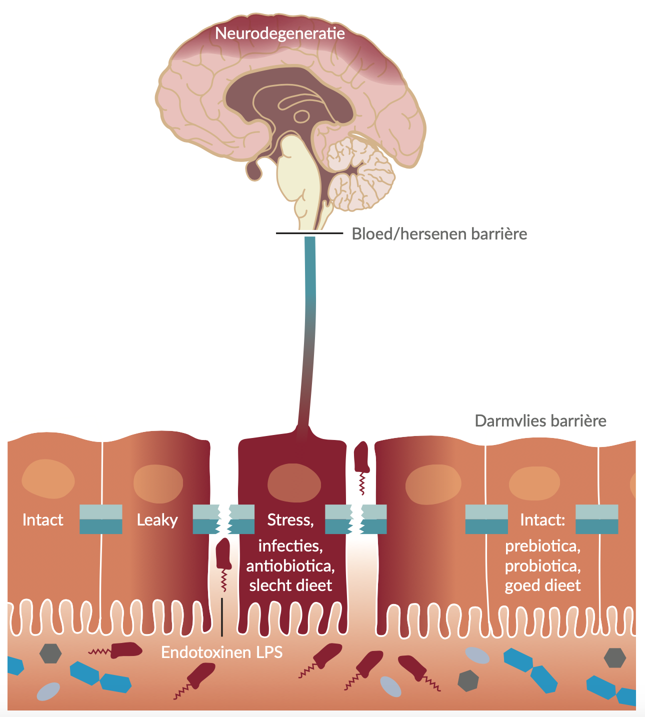 Een leaky gut geeft een verhoogd risico op een leaky brain